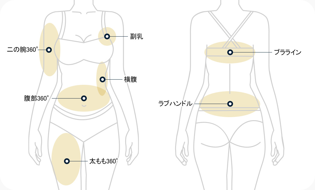 지방흡입 부위 팔 360도 부유방 옆구리 복부 360도 허벅지 360도 브라라인 러브핸들