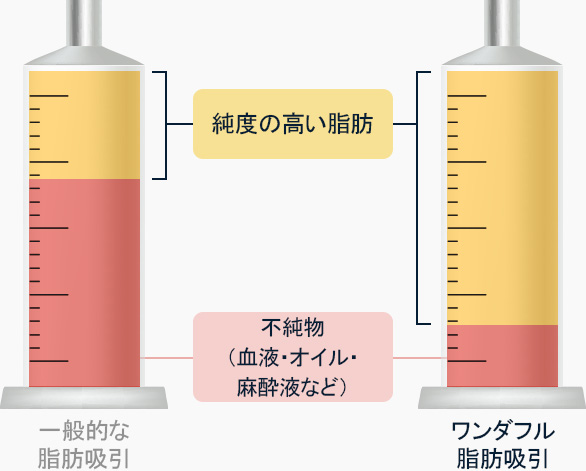 원더풀 바디 지방흡입 불순물 혈액 오일 마취용액 등 보다 높은 비율의 순수지방 추출