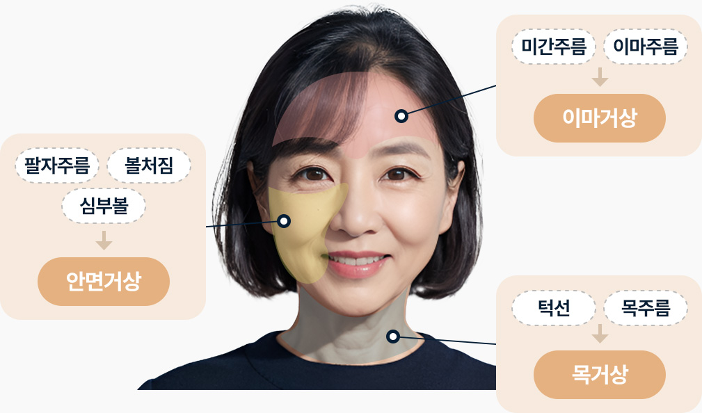 팔자주름 볼처짐 심부볼 안면거상으로 개선 미간주름 이마주름 이마거상으로 개선 턱선 목주름 목거상으로 개선