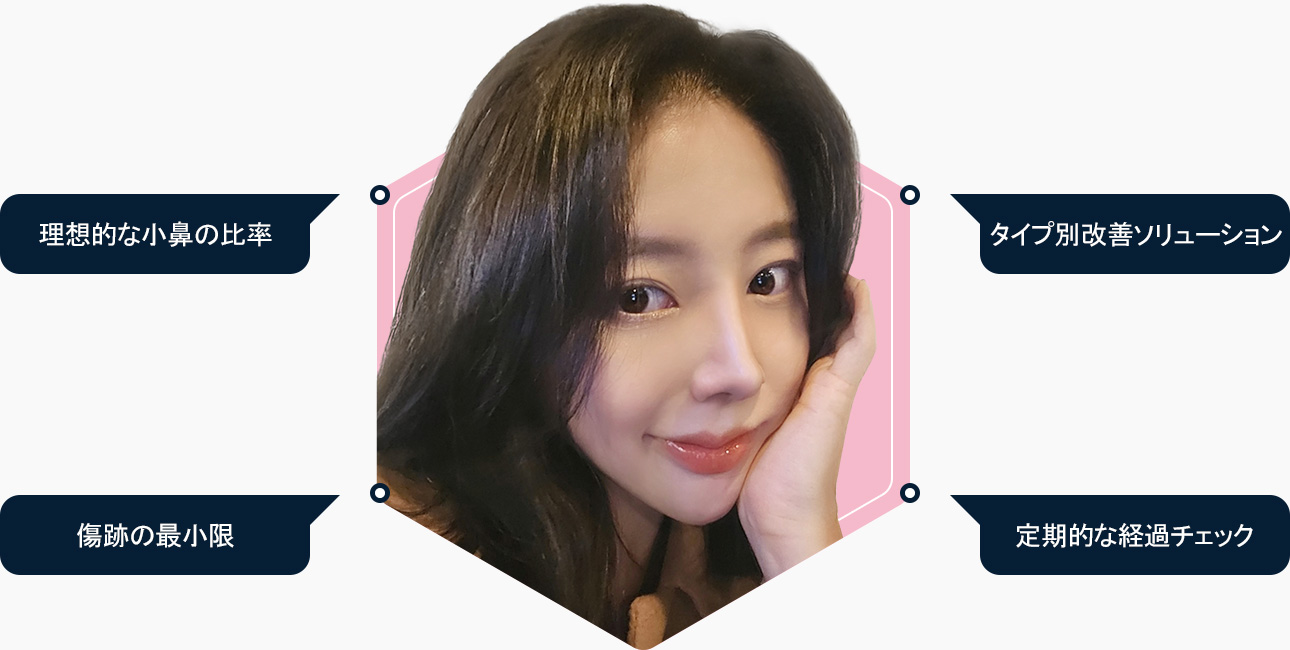 이상적인 콧볼비율 유형별 개선 흉터최소 지속적인 경과체크