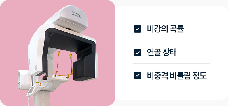 3D CT 비강의 곡률 연골상태 비중격 비틀림