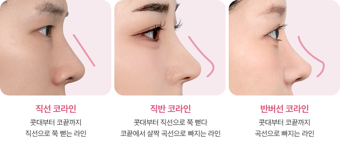 코성형 직선 코라인 직반 코라인 반버선 코라인
