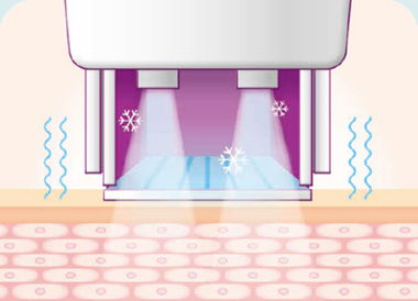 써마지FLX 시술방법 피부 보호를 위한 쿨링 시스템작동