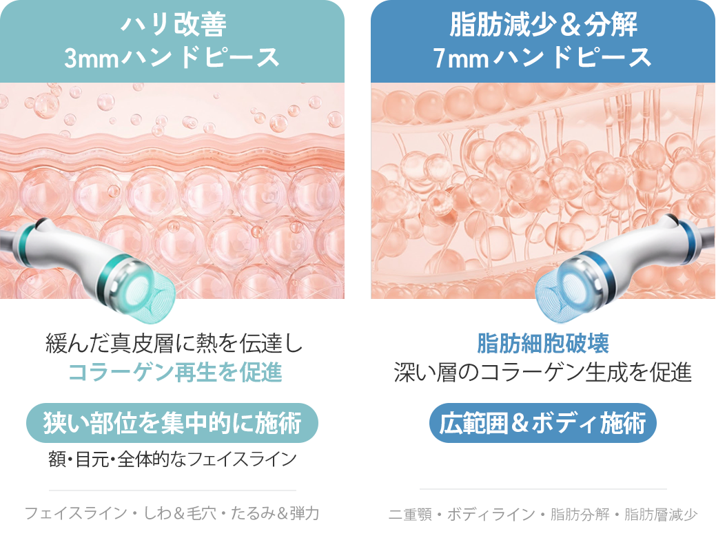 탄력 개선 3mm 핸드피스와 지방 감소 7mm 핸드피스